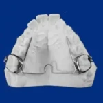 appareil Raymond en orthodontie à Aigues-Mortes entre Montpellier, Nîmes, Vauvert et Lunel