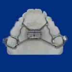 disjoncteur pour appareil dentaire enfant, adolescent et adulte