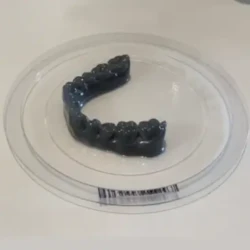 Empreinte 3D fabriquée sur place empreinte dentaire 3D laser fabriquée au cabinet orthodontique entre Montpellier, Lunel, Vauvert et Nîmes